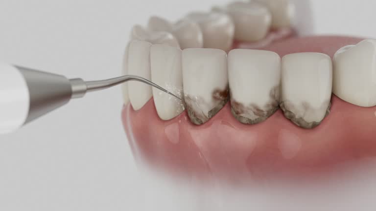Trusted Teeth Cleaning And Checkup service in Spout Springs, NC - Dentist Open Now
